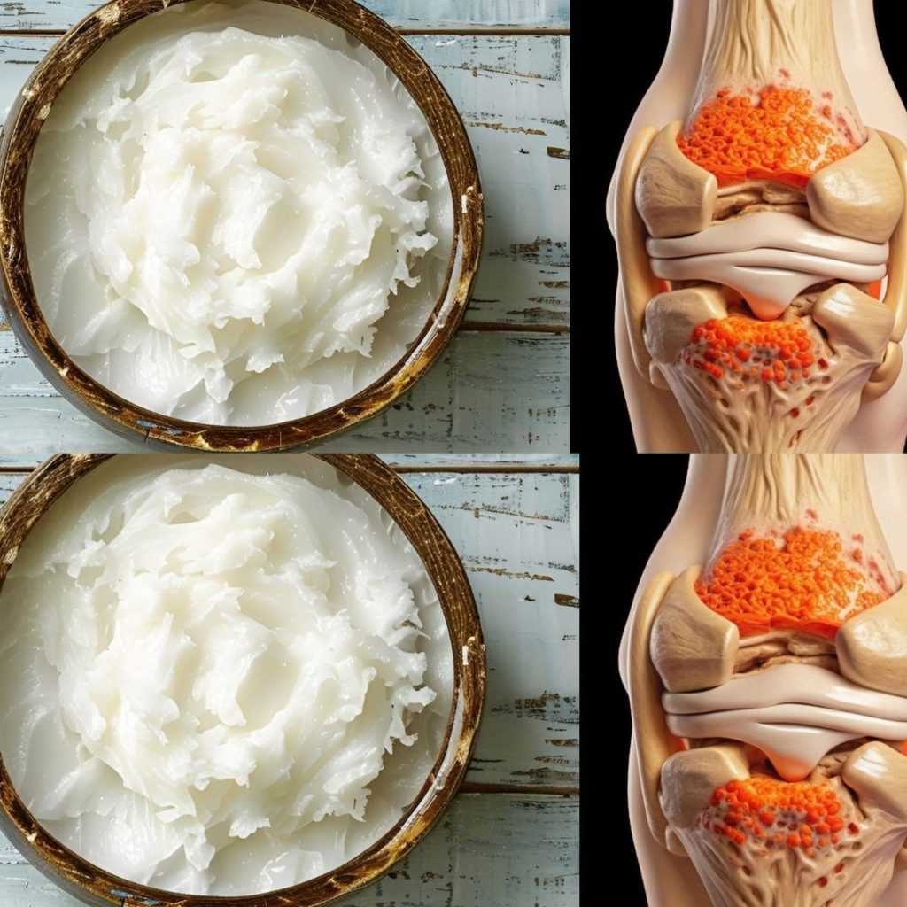 Top Foods to Rebuild Knee Cartilage 1. Bone Broth Why: Bone broth is rich in collagen, glucosamine, and chondroitin—key components for cartilage repair. How to Use: Drink a cup daily or use it as a base for soups and stews. 2. Fatty Fish (Salmon, Mackerel, Sardines) Why: Loaded with omega-3 fatty acids, which reduce inflammation and support joint health. How to Use: Aim for 2–3 servings of fatty fish per week. 3. Leafy Greens (Spinach, Kale, Broccoli) Why: High in vitamins C and K, which aid in collagen synthesis and protect cartilage. How to Use: Add them to salads, smoothies, or soups. 4. Citrus Fruits (Oranges, Lemons, Grapefruits) Why: Packed with vitamin C, essential for collagen production. How to Use: Eat fresh or squeeze into water for a refreshing drink. 5. Nuts and Seeds (Almonds, Walnuts, Chia Seeds, Flaxseeds) Why: Rich in omega-3s, vitamin E, and anti-inflammatory compounds. How to Use: Snack on a handful daily or sprinkle over oatmeal or yogurt.  Read more on next page