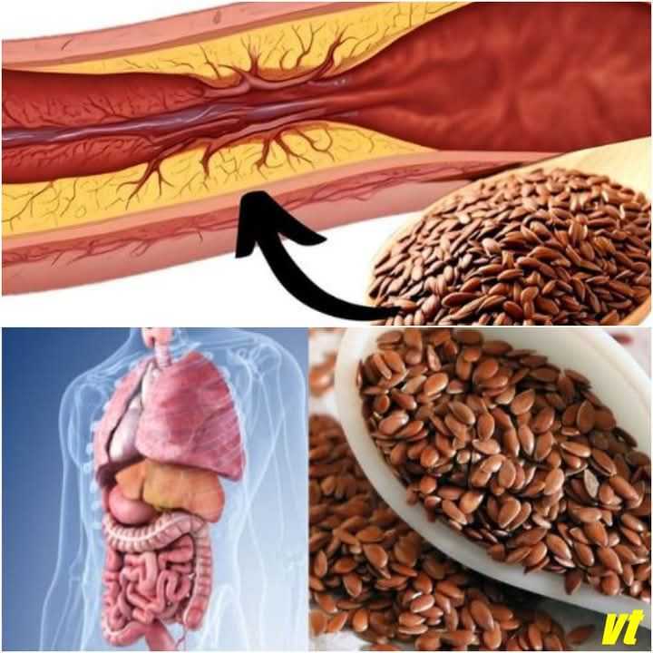 https://dishrecipes.ma2roc.tech/1-tablespoon-a-day-flaxseed-to-prevent-blood-clots-heart-attacks-and-strokes/?fbclid=IwY2xjawKHgEBleHRuA2FlbQIxMABicmlkETFsUDJDdHU2RTF1ZlhhRXBrAR4EjvZYwmGFepScGWRO7uzFQLnmRbZJ8vaS7FU83lU77tqRXCcCfZkiPkZP9Q_aem_pcZsDOYa5rmDYt4GyJMg3g#:~:text=1%20Tablespoon%20A%20Day%3A%20Flaxseed%20To%20Prevent%20Blood%20Clots%2C%20Heart%20Attacks%2C%20And%20Strokes